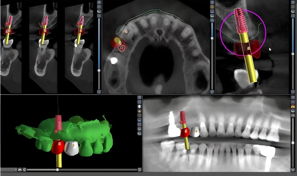 replicate prediction kveb03se0xrmw0cwxj4btm785g