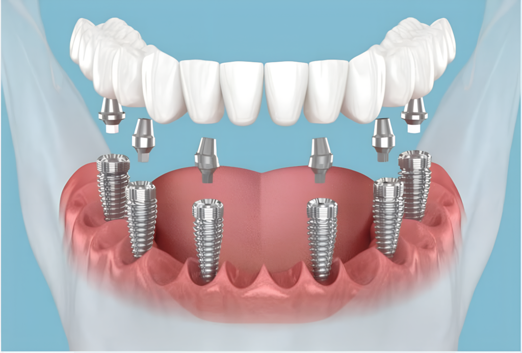 replicate prediction q9djn5wt4srmr0cwxj49cwzs2w